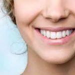 What Not To Do After Getting Veneers?