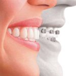 How To Reduce The Risk Of Dental Problems